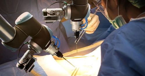 醫(yī)療器械開發(fā)的自動化浪潮 驅(qū)動大型醫(yī)療器械自動化的核心原因